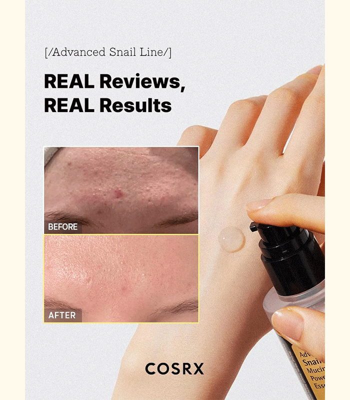 COSRX Snail Mucin - COSRX Advanced Snail 96 Mucin Power Essence 100ml - Image 6